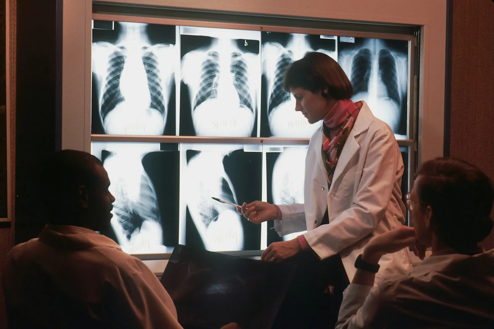 A doctor discussing chest X-rays with other people